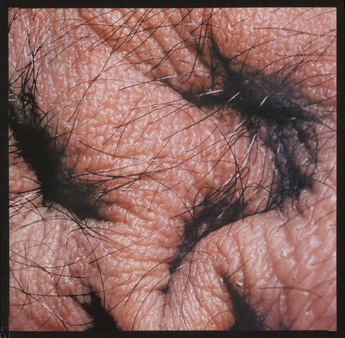 Asshole Snail dilemma