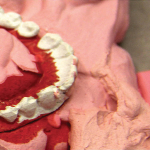 Malagrazia_______Landfall